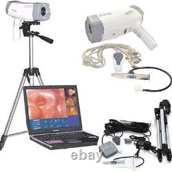 480K pixels Digital Video Electronic Colposcope Gynecology Camera andTripod