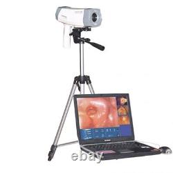 Carejoy 480,000 Digital Video Electronic Colposcope Camera Gynecology Tripod