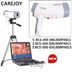 Carejoy Digital Electronic Colposcope Vaginal Image RCS-400/RCS-500-FDA