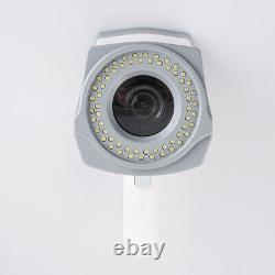 Carejoy Digital Video Electronic Colposcope 480,000px Camera Tripod Software FDA