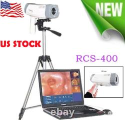 Carejoy Digital Video Electronic Colposcope RCS-400 480,000 Camera+Tripod Set-US