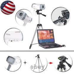 Carejoy SONY 480K Pix Camera Software Tripod Digital Video Electronic Colposcope