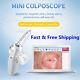 Digital Portable Video Electronic Mini Colposcope Fa2 With 3000000 Pixels Camera