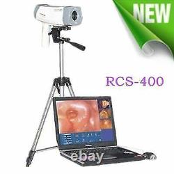 Digital Video Electronic Coloposcope 800k Pixels Camera Software Tripod RCS-400