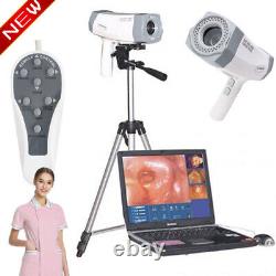 Digital Video Electronic Colposcope 480,000 Pix Camera Software &Tripod CE FDA