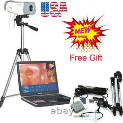 Digital Video Electronic Colposcope 480,000 Pix Camera Software&Tripod FDA