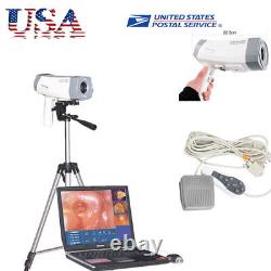 Digital Video Electronic Colposcope 480000 Pixels Camera Zoom+Tripod Medical