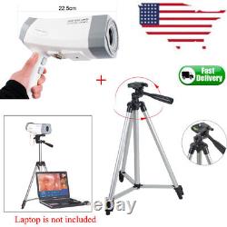 Digital Video Electronic Colposcope 480000 Pixels Color Camera With Tripod CE