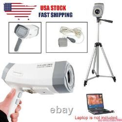 Digital Video Electronic Colposcope 480000 Pixels Zoom Camera + Stand + Software