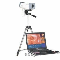Digital Video Electronic Colposcope Hysterocolposcope Gynecology CE FDA A+