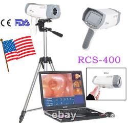 Medical Digital Video Electronic Colposcope 480,000 Color Camera Tripod Carejoy