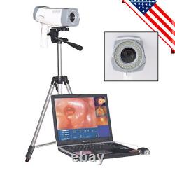 NEW Digital Video Electronic Colposcope 480,000 Pixels Camera Software +Tripod