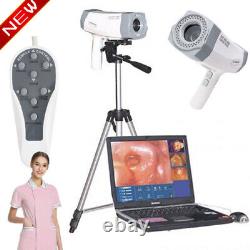 NEW Digital Video Electronic Colposcope 480,000 Pixels Camera Software +Tripod